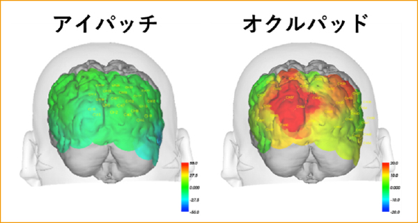fNIRSを用いた視覚野の活性化の比較