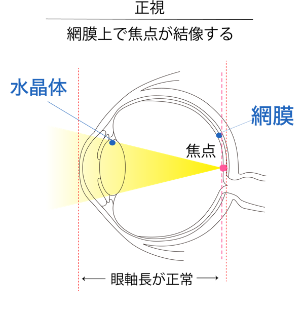 正視